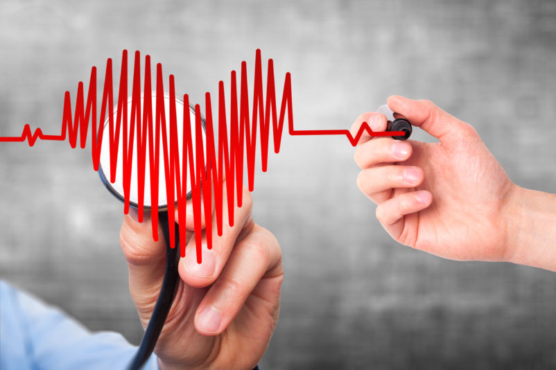 Xarelto completes successfully Phase III of clinical trial. Used for preventing myocardial infarction and stroke